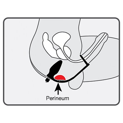 Anal Plug Vibrator cu Inel Ro-Zen Negru