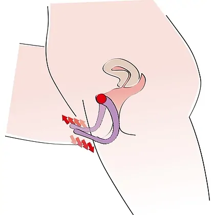 Genital Spreader Punctul G Mov