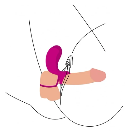 Inel Dublă Stimulare Couples Stimulator Ring Fuchsia